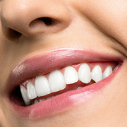 How To Prepare For Teeth Whitening?