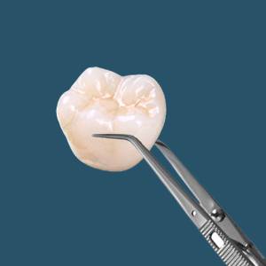 5 Different Types of Dental Crowns Available in Newark