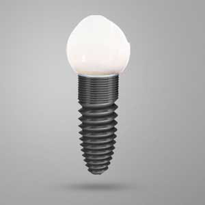 5 Tips for Looking After Your Dental Implants in Newark