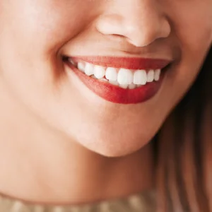 Aftercare Tips for the Success of Teeth Whitening in Newark