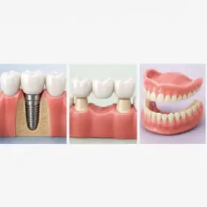 Helpful dental information about dental implants Newark NJ